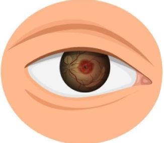 imgi 18 Age-related-vision-decline 57f8f88f-1922-448e-9157-2c3bf6ccb1c7